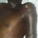 Man severely burned with cooking oil by wife