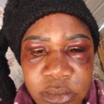 Woman Recalls How She Was Robbed of Over N$12,000 and Beaten by Men Posing as Taxi Drivers