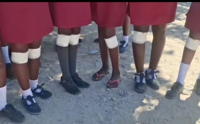 Six Learners Injured After Being Forced to Crawl by Teacher in Kavango West