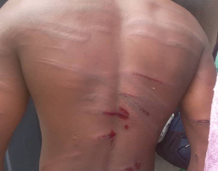 Inmates Allege Assault by Police Officers at Rundu Holding Cells