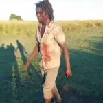 Man Survives Lion Attack in Kasika, Injured While Defending Herd