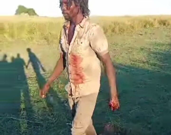 Man Survives Lion Attack in…