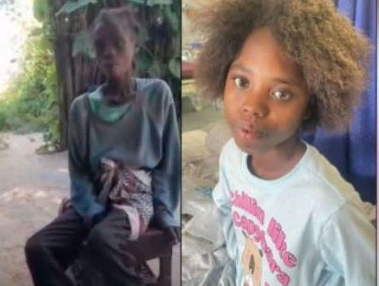 Public Support Brings Hope and Healing to Abused Angolan Teen 7 FB IMG 17748476735252