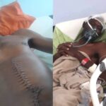 Witnesses dispute police account in Melvin ||Areseb assault case