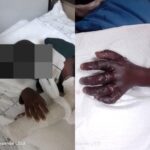 Health ministry probes child’s arm amputation after mother’s negligence allegations