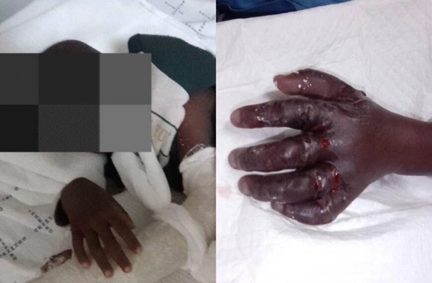 Health ministry probes child’s arm amputation after mother’s negligence allegations